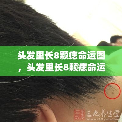 头发痣相揭秘,命运纹理细探与痣相命运图解读