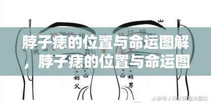 脖子痣的位置与命运图解,痣相揭示人生轨迹之谜