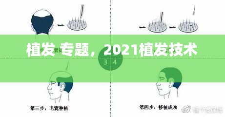 植发 专题,2021植发技术
